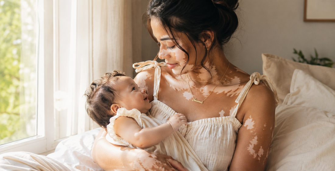 Jeune maman avec vitiligo tenant son bébé près d’une fenêtre, portant un collier personnalisé doré dans une lumière matinale douce, pour illustrer un article sur le bijou de naissance.