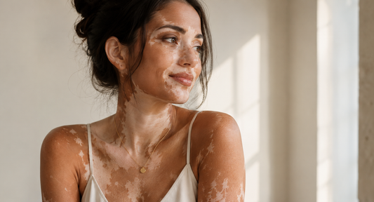 Femme portant un collier doré délicat, avec une peau marquée par le vitiligo, dans une lumière naturelle douce et une ambiance élégante et apaisante.