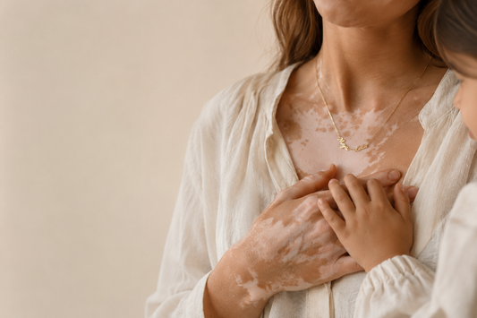 Bannière émotionnelle montrant la main d’une maman avec vitiligo et celle d’un enfant se touchant doucement, avec un collier personnalisé doré porté près du cœur, dans une lumière naturelle et chaleureuse.