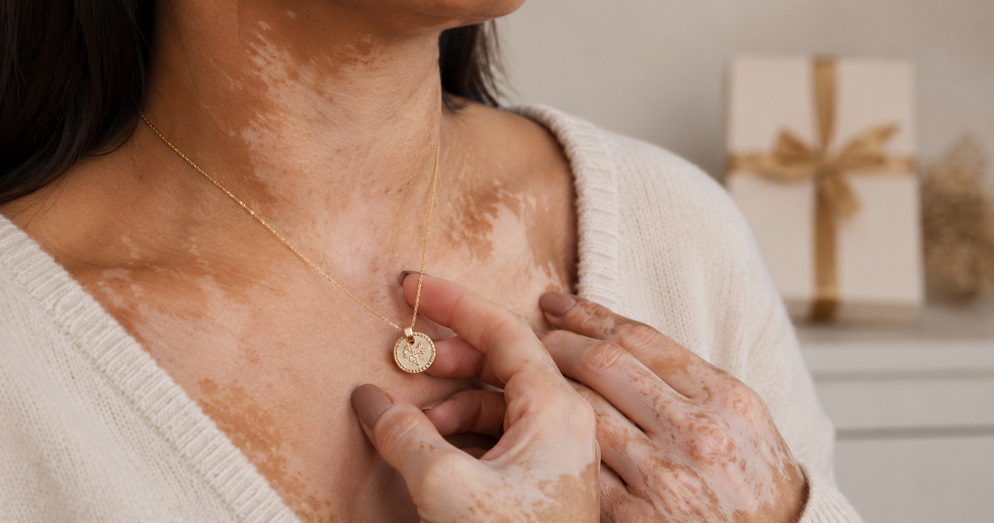 Femme avec vitiligo portant un collier doré personnalisé près du cœur, symbole d’un cadeau émotionnel et durable.
